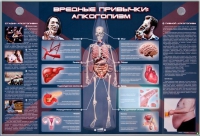 Электрифицированный стенд "Вредные привычки: алкоголизм" - «globural.ru» - Чебоксары