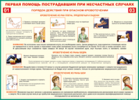 Таблица Порядок действий при опасном кровотечении 1000*1400 винил - «globural.ru» - Чебоксары