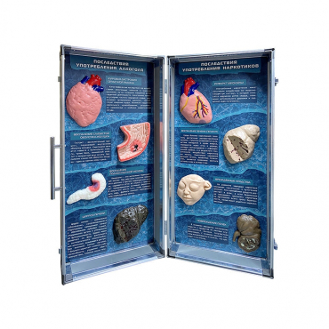 Учебно-демонстрационный кейс "Последствия употребления алкоголя и наркотиков" - «globural.ru» - Чебоксары